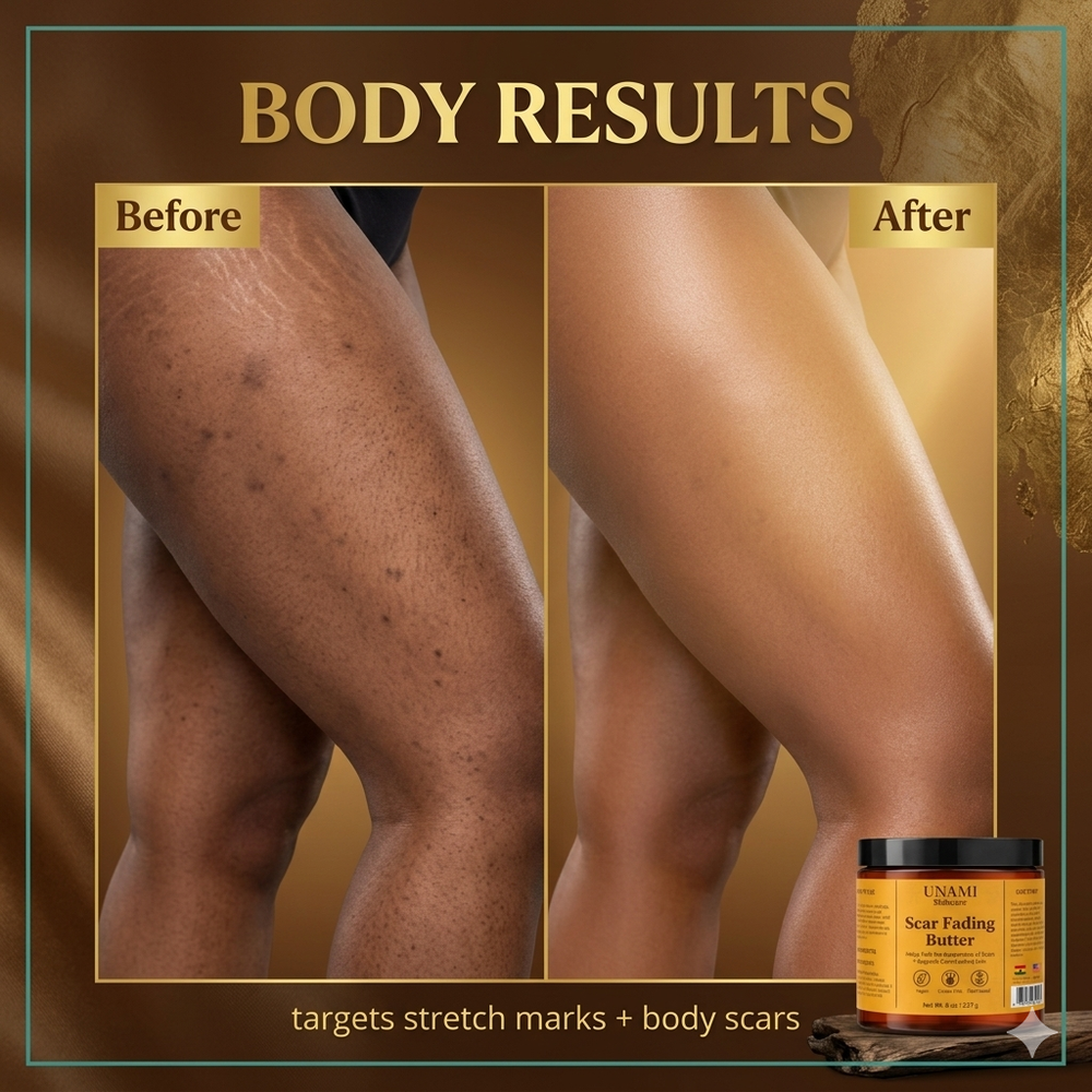 Scar Fading Body Butter | Stretch Mark & Dark Spot Treatment